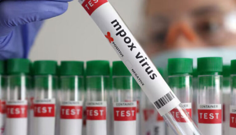 В Англии был обнаружен новый случай MPOX: каковы симптомы заболевания?