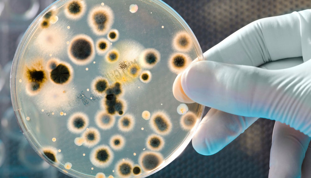 В водохранилищах Украины - повышенный уровень Escherichia coli: каждый пятый тест не соответствует стандартам