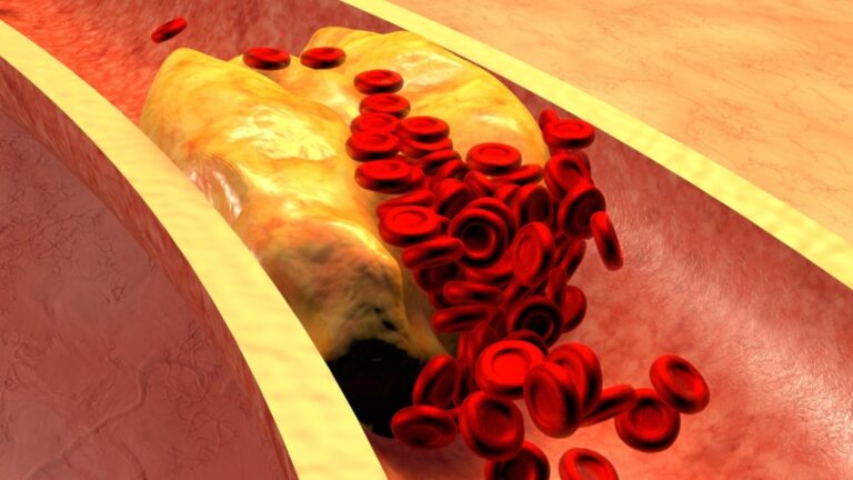 Обнаружено, какой дешевый овощ снизил плохой холестерин на 20%