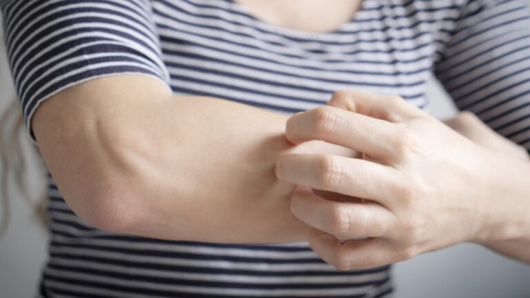 7 ранних симптомов страданий от высокой мочевой кислоты