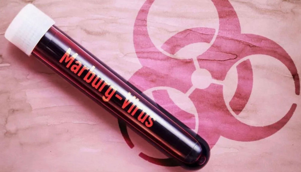 Первые случаи смерти от вируса Марбург зафиксированы в Эфиопии