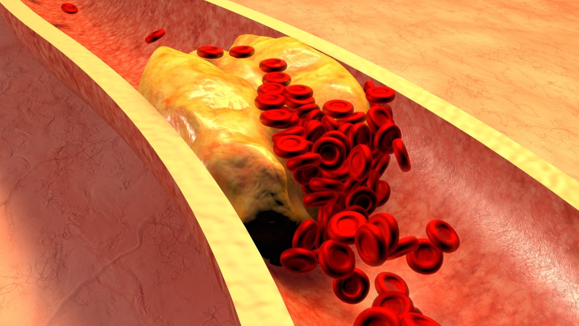 Доктор долголетия говорит, что уровень холестерина неправильно понимают – вот правда