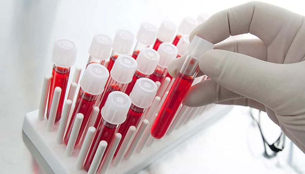 Стоит ли сдавать анализы на гепатит В и С: что нужно знать