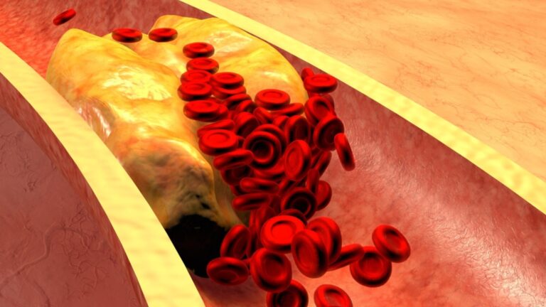 Холестерин не переходит из поколения в поколение