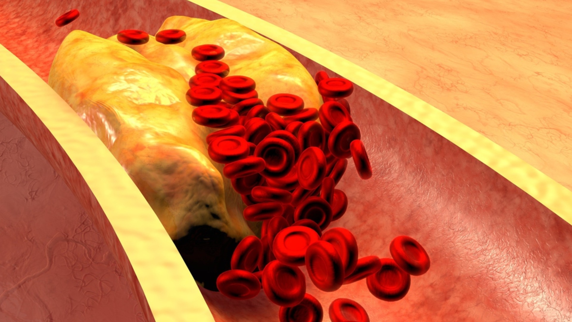 Холестерин не переходит из поколения в поколение