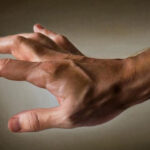 Ежегодно в мире регистрируется 200 000 случаев проказы: что это за болезнь?