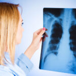 Более 1300 случаев в месяц: статистика туберкулёза в Украине за декабрь 2025 года