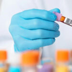 Статистика ВИЧ/СПИДа в Украине: декабрь 2025 г.