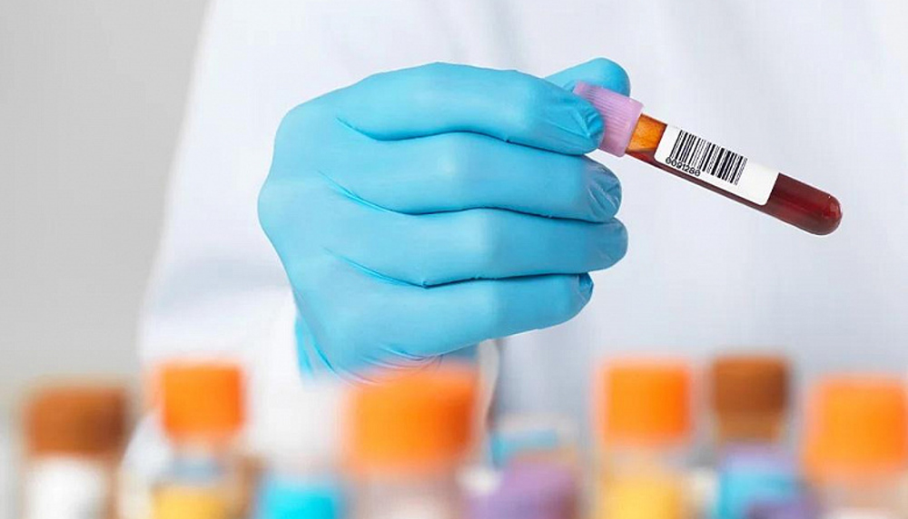 Статистика ВИЧ/СПИДа в Украине: декабрь 2025 г.