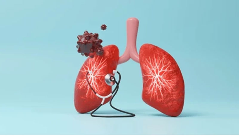 Более 1000 новых случаев туберкулеза зафиксировано в январе 2026 года