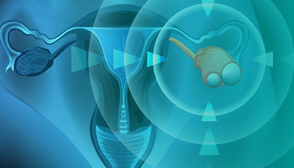 Препарат от Corcept для лечения рака яичников получил одобрение FDA