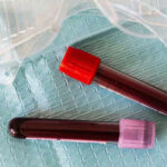 Новый анализ крови может предсказать болезни сердца за 15 лет