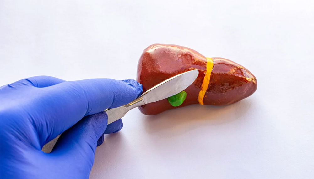 В Украине впервые разработаны протоколы лечения осложнений цирроза печени