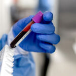 В Украине стартует национальное исследование по факторам риска неинфекционных заболеваний