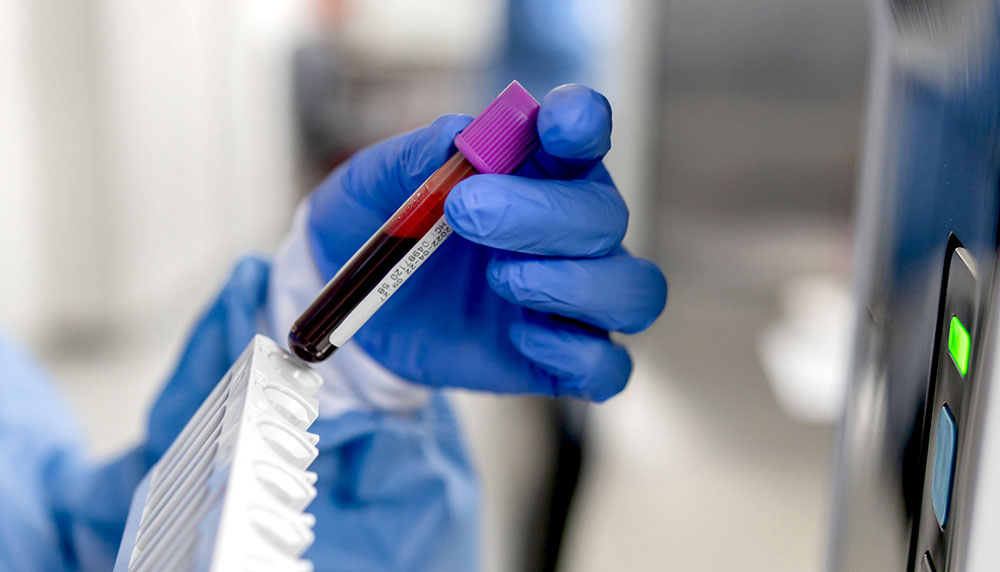 В Украине стартует национальное исследование по факторам риска неинфекционных заболеваний