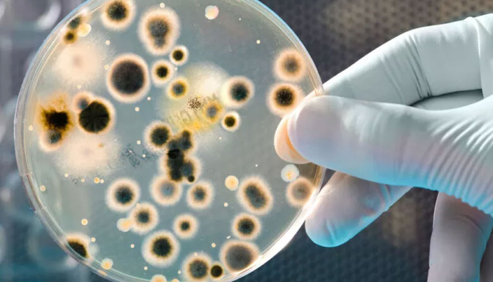 В Украине повышают готовность к реагированию на вспышки инфекционных заболеваний